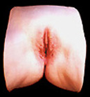 ea-b-lipscopy.jpg (14517 bytes)