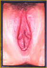ea-p-lipscopy.jpg (16479 bytes)